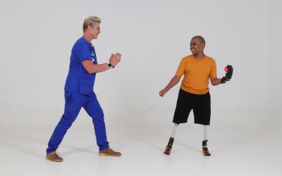 3D printed hands for children who have suffered amputation of upper limbs